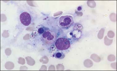 PP.09 Hemophagocytic lymphohistiocytosis induced by visceral ...