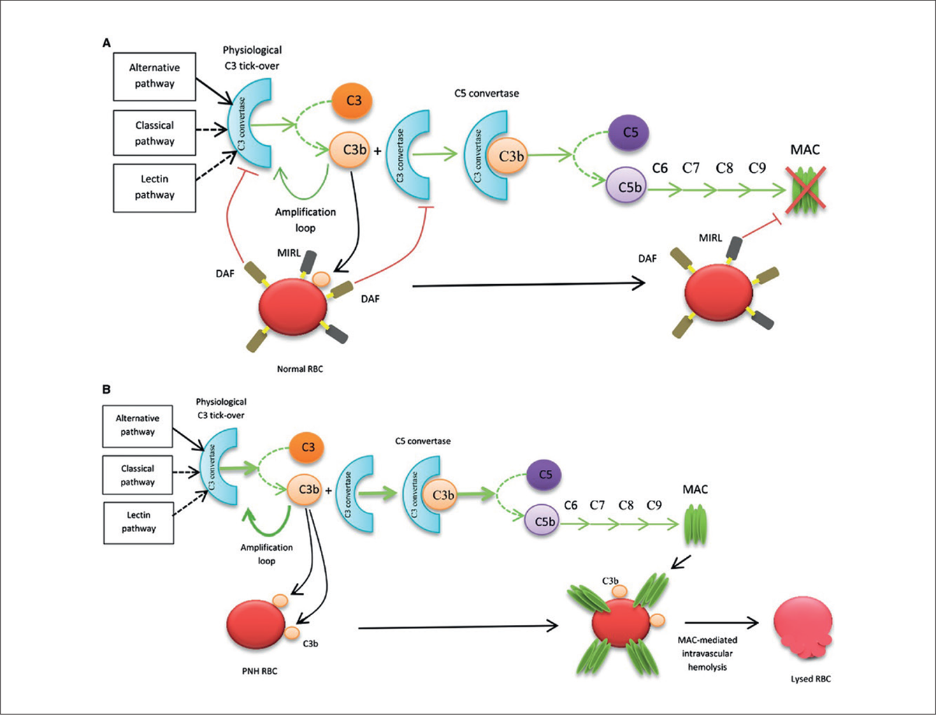 Paroxysmal nocturnal haemoglobinuria: from diagnosis to management - BJH