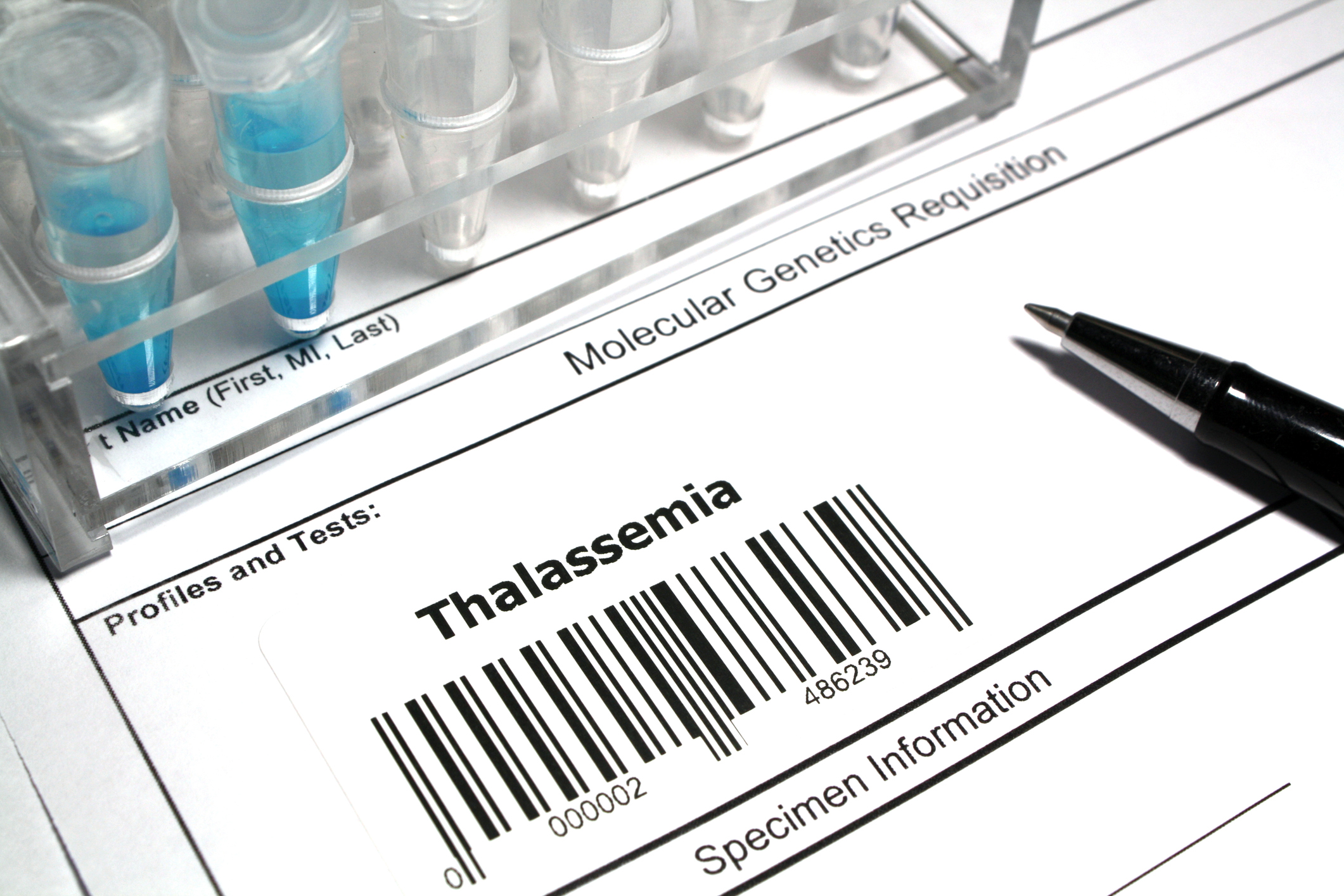 Betibeglogene Autotemcel Gene Therapy For Transfusion-dependent β ...