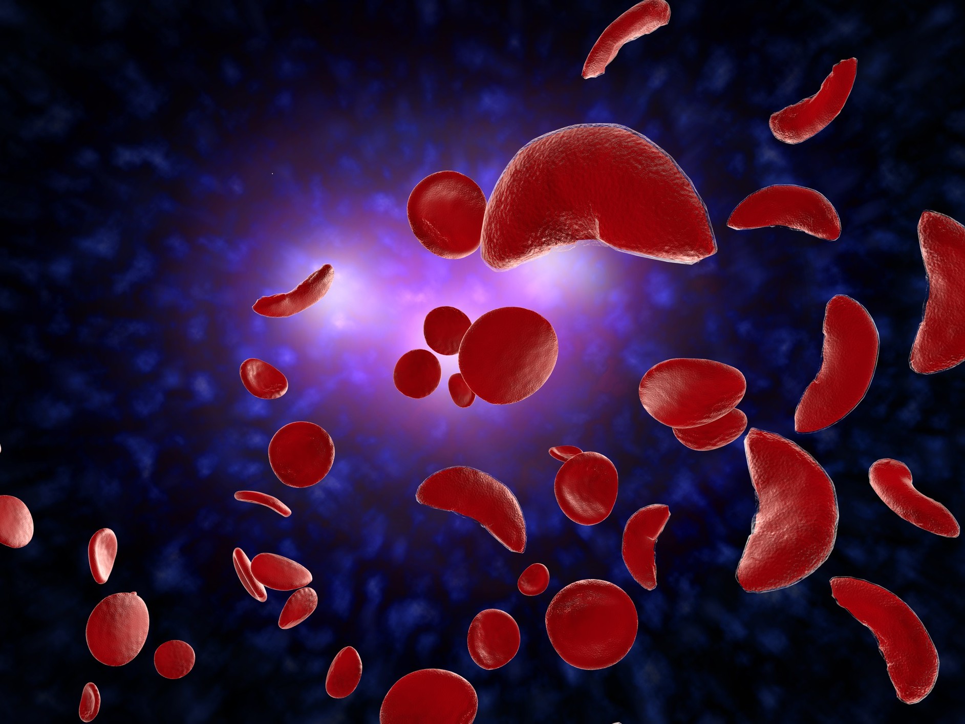 clinical-efficacy-of-non-pharmacological-therapy-for-sickle-cell